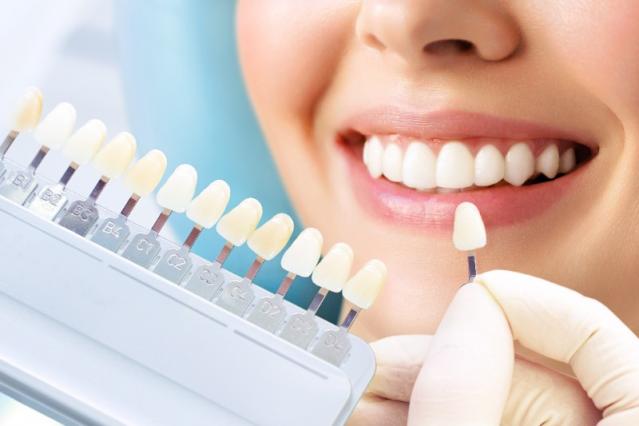 Dentisterie esthétique à Schaerbeek